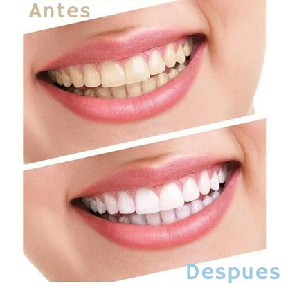 WHITELIGHT™ - OFERTA KIT BLANQUEAMIENTO DENTAL