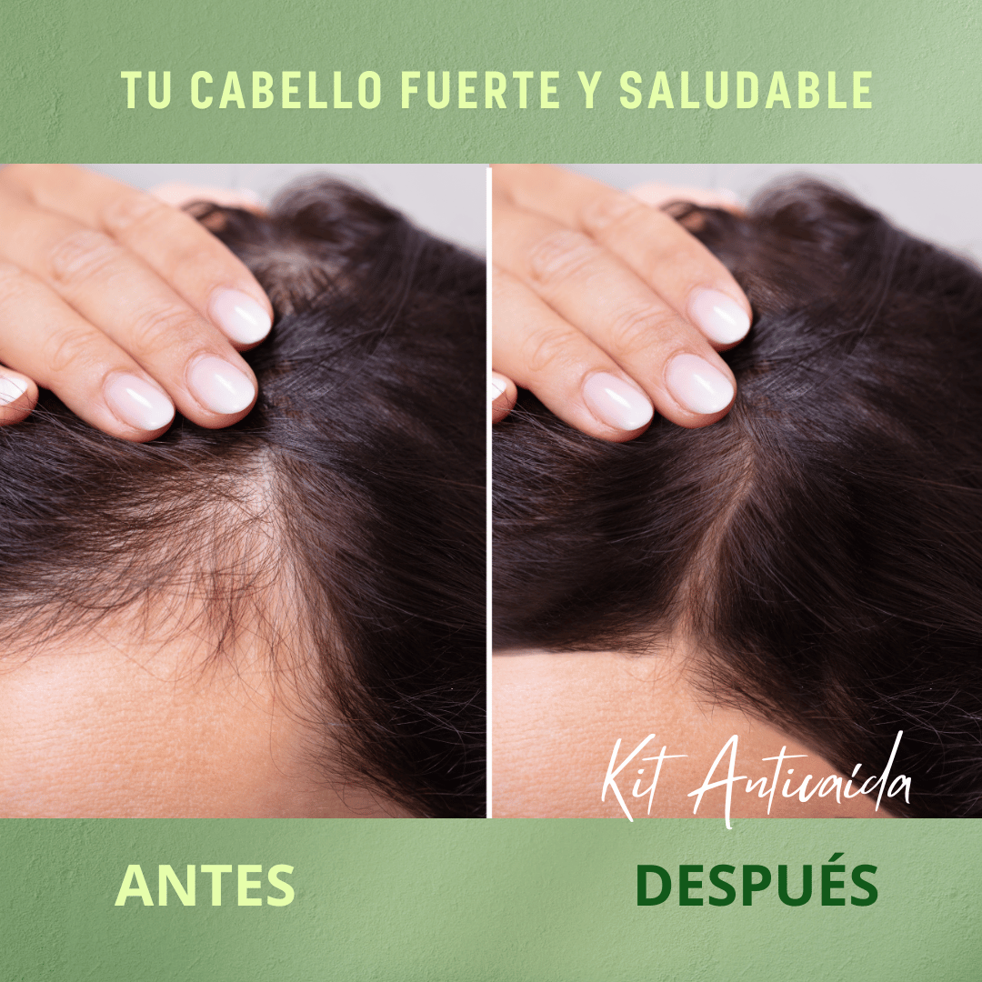 🌱 Kit Anticaída Fuerza Capilar 🌿