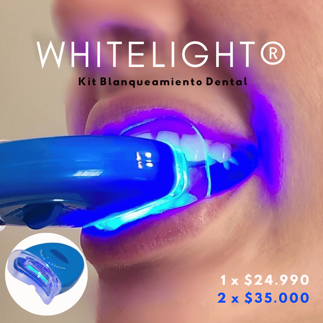 WHITELIGHT™ - OFERTA KIT BLANQUEAMIENTO DENTAL